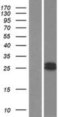 Western Blot: GH2 Overexpression Lysate (Adult Normal) [NBP2-09901] Left-Empty vector transfected control cell lysate (HEK293 cell lysate); Right -Over-expression Lysate for GH2.
