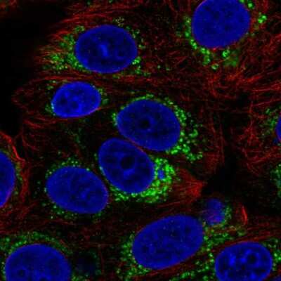 Immunocytochemistry/Immunofluorescence: GHITM Antibody [NBP2-49344] - Immunofluorescent staining of human cell line MCF7 shows localization to mitochondria.