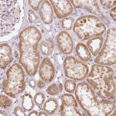 Immunohistochemistry-Paraffin: GHITM Antibody [NBP2-49344] - Staining of human kidney shows moderate cytoplasmic positivity in renal tubules.