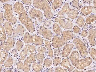 Immunohistochemistry-Paraffin: GHITM Antibody [NBP3-06232] - Immunochemical staining of human GHITM in human kidney with rabbit polyclonal antibody at 1:500 dilution, formalin-fixed paraffin embedded sections.