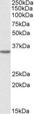 Western Blot GHITM Antibody