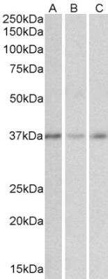 Western Blot GHITM Antibody