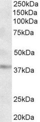 Western Blot: GHITM Antibody [NBP1-52001] (2ug/ml) staining of Human Cer(35ug protein in RIPA buffer). Primary incubation was 1 hour. Detected by chemiluminescence.