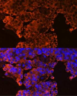 Immunocytochemistry/Immunofluorescence: GHRHR Antibody [NBP3-04431] - Immunofluorescence analysis of rat pituitary gland cells using GHRHR Rabbit pAb (NBP3-04431) at dilution of 1:100 (40x lens). Blue: DAPI for nuclear staining.