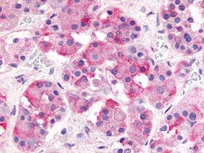 Immunohistochemistry-Paraffin: GHRHR Antibody [NLS834] - Analysis of anti-GHRHR antibody with human pituitary, anterior.