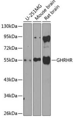 Western Blot: GHRHR Antibody [NBP3-04431] - Analysis of extracts of various cell lines, using GHRHR antibody at 1:1000 dilution. Secondary antibody: HRP Goat Anti-Rabbit IgG (H+L) at 1:10000 dilution. Lysates/proteins: 25ug per lane. Blocking buffer: 3% nonfat dry milk in TBST. Detection: ECL Enhanced Kit