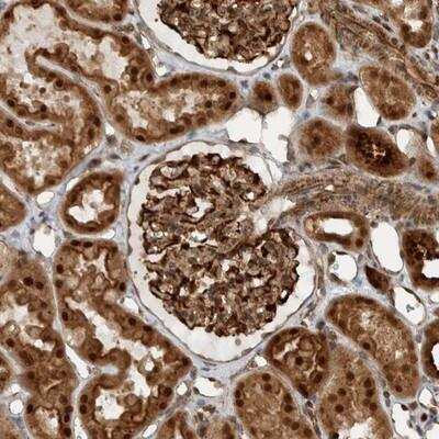 Immunohistochemistry-Paraffin GIGYF1 Antibody