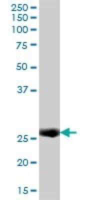 Western Blot: GILT/IFI30 Antibody [H00010437-B01P] - Analysis of IFI30 expression in human spleen.