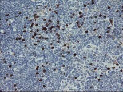 Immunohistochemistry: GIMAP4 Antibody (OTI1A11) - Azide and BSA Free [NBP2-71996] - Analysis of Human lymphoma tissue using GIMAP4 mouse monoclonal antibody.