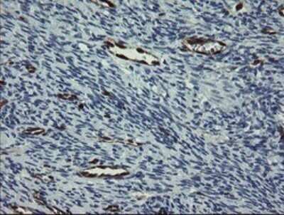 Immunohistochemistry: GIMAP4 Antibody (OTI1A11) - Azide and BSA Free [NBP2-71996] - Analysis of Human Ovary tissue.
