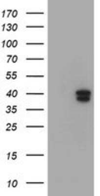 Western Blot: GIMAP4 Antibody (OTI1C6) - Azide and BSA Free [NBP2-71997] - HEK293T cells were transfected with the pCMV6-ENTRY control (Left lane) or pCMV6-ENTRY GIMAP4 (Right lane) cDNA for 48 hrs and lysed. Equivalent amounts of cell lysates (5 ug per lane) were separated by SDS-PAGE and immunoblotted with anti-GIMAP4.
