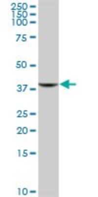 Western Blot: GIMAP4 Antibody [H00055303-B01P] - Analysis of GIMAP4 expression in human spleen.