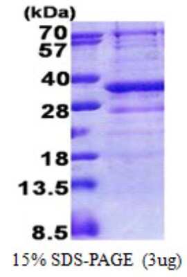 SDS-Page: Recombinant Human GIMAP5 Protein [NBP2-23091]