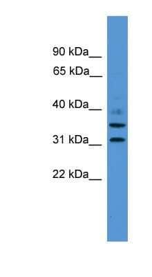 Western Blot: GIMAP6 Antibody [NBP1-79618] - Titration: 0.2-1 ug/ml, Positive Control: THP-1 cell lysate.