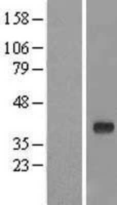 Western Blot: GIMAP7 Overexpression Lysate (Adult Normal) [NBL1-11075] Left-Empty vector transfected control cell lysate (HEK293 cell lysate); Right -Over-expression Lysate for GIMAP7.