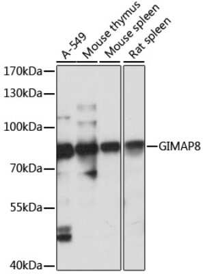 Western Blot: GIMAP8 Antibody [NBP3-04641] - Analysis of extracts of various cell lines, using GIMAP8 antibody at 1:1000 dilution. Secondary antibody: HRP Goat Anti-Rabbit IgG (H+L) at 1:10000 dilution. Lysates/proteins: 25ug per lane. Blocking buffer: 3% nonfat dry milk in TBST. Detection:ECL Basic Kit