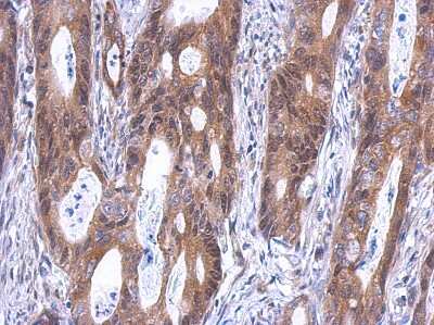 Immunohistochemistry-Paraffin GINS4 Antibody