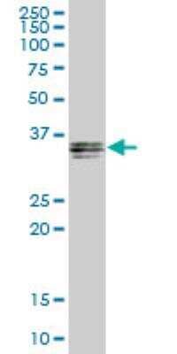 Western Blot: GIPC1 Antibody [H00010755-B01P] - GIPC1 MaxPab polyclonal antibody. Western Blot analysis of GIPC1 expression in human spleen.