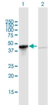 Western Blot GIPC1 Antibody