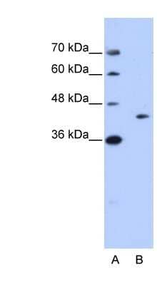 Western Blot: GIPC1 Antibody [NBP1-57426] - Jurkat cell lysate, concentration 0.2-1 ug/ml.