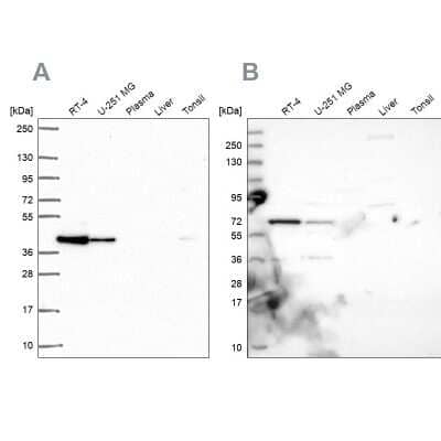 Western Blot: GIPC1 Antibody [NBP2-76557] - Analysis using Anti-GIPC1 antibody NBP2-76557 (A) shows similar pattern to independent antibody NBP1-91941 (B).