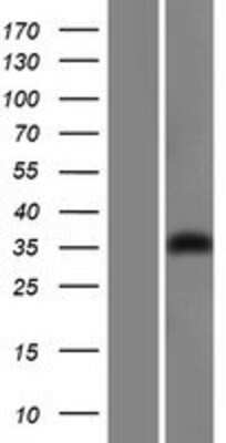 Western Blot: GIPC1 Overexpression Lysate (Adult Normal) [NBL1-11081] Left-Empty vector transfected control cell lysate (HEK293 cell lysate); Right -Over-expression Lysate for GIPC1.