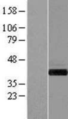 Western Blot: GIPC1 Overexpression Lysate (Adult Normal) [NBP2-04568] Left-Empty vector transfected control cell lysate (HEK293 cell lysate); Right -Over-expression Lysate for GIPC1.