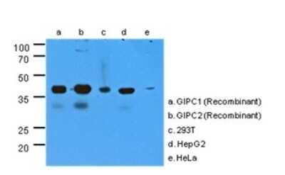 Western Blot: GIPC2 Antibody (1G10) [NBP2-22552] - The cell lysates (40ug) were resolved by SDS-PAGE, transferred to PVDF membrane and probed with anti-human GIPC antibody (1:1000). Proteins were visualized using a goat anti-mouse secondary antibody conjugated to HRP and an ECL detection system.The cross-reacting of anti-human GIPC (AT1G10) were analyzed by using recombinant protein(20ng) of GIPC1 and GIPC2.