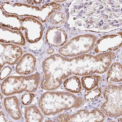 Immunohistochemistry-Paraffin: GIPC2 Antibody [NBP2-49371] - Staining of human kidney shows strong cytoplasmic positivity in renal tubules.