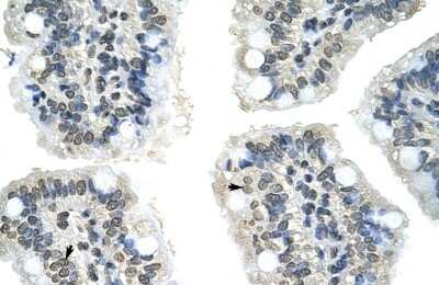 Immunohistochemistry-Paraffin: GIPC2 Antibody [NBP1-55244] - Human Intestine Tissue, antibody concentration 4-8ug/ml. Cells with positive label: Epithelial cells of intestinal villus (indicated with arrows) 400X magnification.