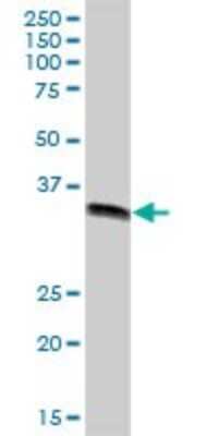 Western Blot: GIPC2 Antibody [H00054810-B01P] - Analysis of GIPC2 expression in human colon.