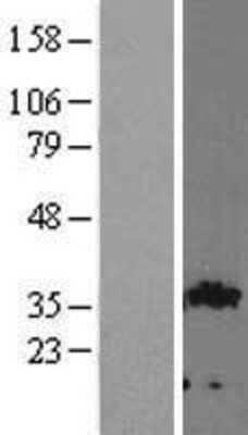 Western Blot: GIPC2 Overexpression Lysate (Adult Normal) [NBL1-11082] Left-Empty vector transfected control cell lysate (HEK293 cell lysate); Right -Over-expression Lysate for GIPC2.