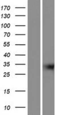 Western Blot: GIPC3 Overexpression Lysate (Adult Normal) [NBP2-05711] Left-Empty vector transfected control cell lysate (HEK293 cell lysate); Right -Over-expression Lysate for GIPC3.