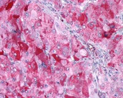 Immunohistochemistry-Paraffin: GIPR Antibody [NLS3840] - Analysis of anti-GIPR / GIP Receptor antibody with human adrenal, pheochromocytoma.