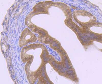 Immunohistochemistry-Paraffin: GIT1 Antibody (JU33-39) [NBP2-75505] - Analysis of paraffin-embedded mouse fallopian tubes tissue using anti-GIT1 antibody. Counter stained with hematoxylin.