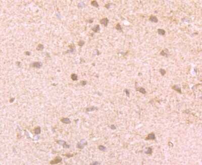Immunohistochemistry-Paraffin: GIT1 Antibody (JU33-39) [NBP2-75505] - Analysis of paraffin-embedded rat brain tissue using anti-GIT1 antibody. Counter stained with hematoxylin.
