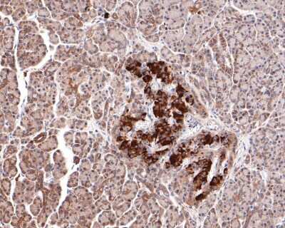 Immunohistochemistry-Paraffin: GIT1 Antibody (JU33-39) [NBP2-75505] - Analysis of paraffin-embedded human pancreas tissue with Rabbit anti-GIT1 antibody washed with ddH2O and PBS, and then probed with the primary antibody  at 1/400 dilution for 1 hour at room temperature. The detection was performed using an HRP conjugated compact polymer system. DAB was used as the chromogen. Tissues were counterstained with hematoxylin and mounted with DPX.