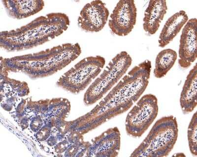 Immunohistochemistry-Paraffin: GIT1 Antibody (JU33-39) [NBP2-75505] - Analysis of paraffin-embedded mouse small intestine tissue with Rabbit anti-GIT1 antibody washed with ddH2O and PBS, and then probed with the primary antibody  at 1/400 dilution for 1 hour at room temperature. The detection was performed using an HRP conjugated compact polymer system. DAB was used as the chromogen. Tissues were counterstained with hematoxylin and mounted with DPX.