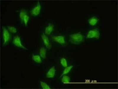 Immunocytochemistry/Immunofluorescence: GIT2 Antibody (3B5-B9) [H00009815-M01] - Analysis of monoclonal antibody to GIT2 on HeLa cell. Antibody concentration 20 ug/ml.