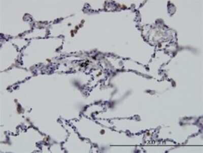 Immunohistochemistry-Paraffin: GIT2 Antibody (3B5-B9) [H00009815-M01] - Analysis of monoclonal antibody to GIT2 on formalin-fixed paraffin-embedded human lung. Antibody concentration 3 ug/ml.