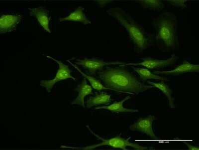 Immunocytochemistry/Immunofluorescence: GIT2 Antibody [H00009815-D01P] - Analysis of antibody to GIT2 on HeLa cell. Antibody concentration 10 ug/ml.
