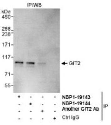 Immunoprecipitation: GIT2 Antibody [NBP1-19143] - Whole cell lysate (1 mg for IP, 20% of IP loaded) from HeLa cells.  NBP1-19143 used for IP at 3 mcg/mg lysate. GIT2 was also immunoprecipitated by  NBP1-19144 which recognize downstream epitopes.