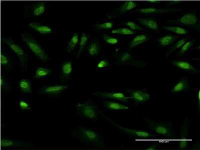 Immunocytochemistry/Immunofluorescence: GIT2 Antibody (M1) [H00009815-M03] - Analysis of monoclonal antibody to GIT2 on HeLa cell. Antibody concentration 10 ug/ml