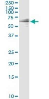 Western Blot: GIT2 Antibody (M1) [H00009815-M03] - Analysis of GIT2 transfected lysate using anti-GIT2 monoclonal antibody and Protein A Magnetic Bead, and immunoblotted with GIT2 rabbit polyclonal antibody.