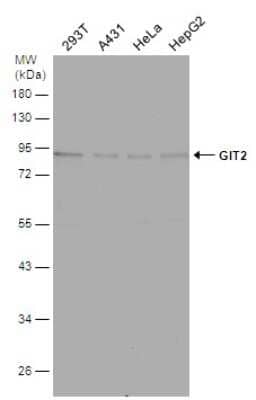 Western Blot: GIT2 Antibody [NBP3-13188] - Various whole cell extracts (30 ug) were separated by 10% SDS-PAGE, and the membrane was blotted with GIT2 antibody (NBP3-13188) diluted at 1:1000.