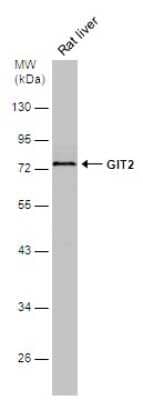 Western Blot: GIT2 Antibody [NBP3-13188] - Rat tissue extract (50 ug) was separated by 10% SDS-PAGE, and the membrane was blotted with GIT2 antibody (NBP3-13188) diluted at 1:1000.