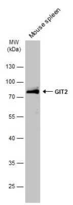 Western Blot: GIT2 Antibody [NBP3-13188] - Mouse tissue extract (50 ug) was separated by 10% SDS-PAGE, and the membrane was blotted with GIT2 antibody (NBP3-13188) diluted at 1:4000. The HRP-conjugated anti-rabbit IgG antibody (NBP2-19301) was used to detect the primary antibody.