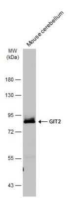 Western Blot: GIT2 Antibody [NBP3-13188] - Mouse tissue extract (50 ug) was separated by 7.5% SDS-PAGE, and the membrane was blotted with GIT2 antibody (NBP3-13188) diluted at 1:4000. The HRP-conjugated anti-rabbit IgG antibody (NBP2-19301) was used to detect the primary antibody.