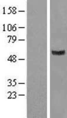 Western Blot: GIT2 Overexpression Lysate (Adult Normal) [NBL1-11084] Left-Empty vector transfected control cell lysate (HEK293 cell lysate); Right -Over-expression Lysate for GIT2.