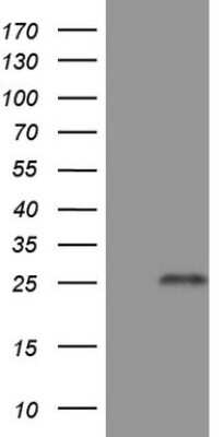 Western Blot: GITR/TNFRSF18 Antibody (9G8) [NBP2-46156] - Analysis of HEK293T cells were transfected with the pCMV6-ENTRY control (Left lane) or pCMV6-ENTRY TNFRSF18.